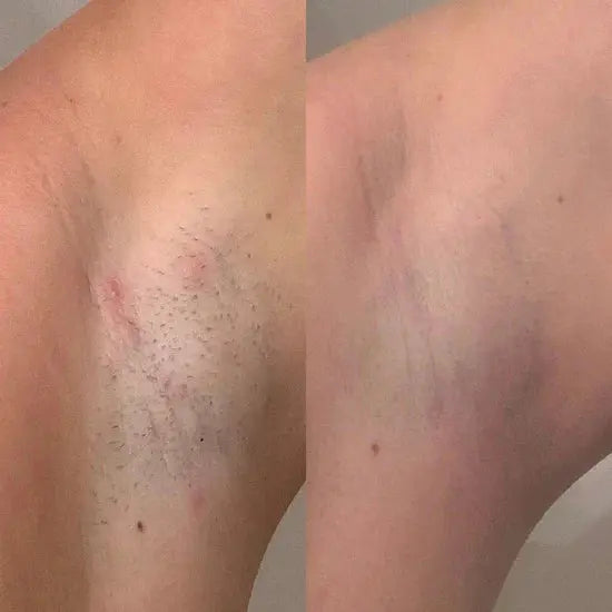 Une peau douce, sans effort